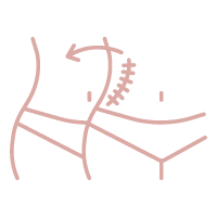 cicatrices